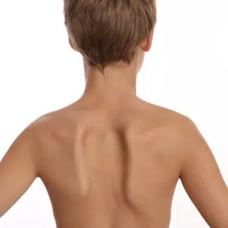 Espalda de niños mostrando sus omóplatos que son desiguales