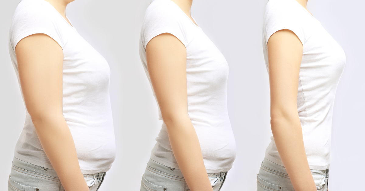 3 images of woman who has lost weight over time