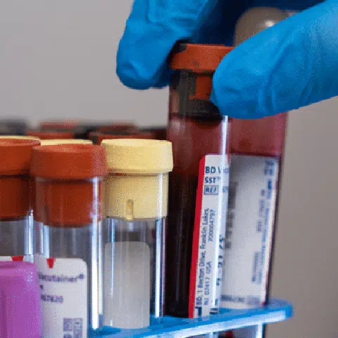 Blood vials for lab testing