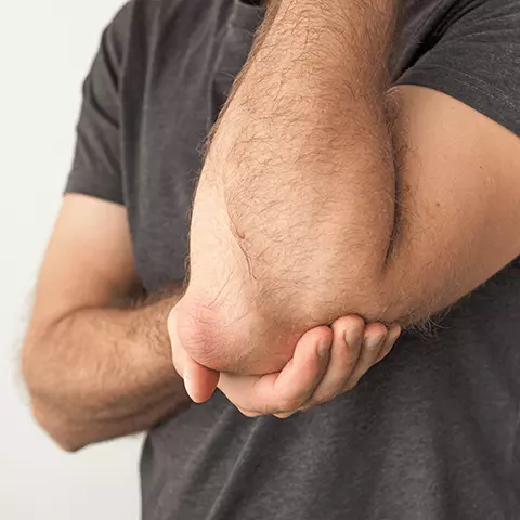 Man holding his inflamed elbow in front of his chest